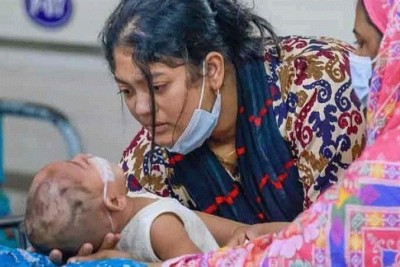 একদিনে হামের উপসর্গে আরও ৮ শিশুর মৃত্যু